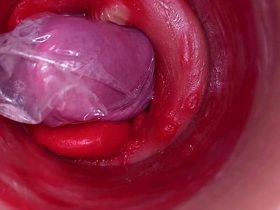 be imparted to murder camera median be imparted to murder deep pussy records a giving ejaculation with a stuck condom eishin gay porn japan