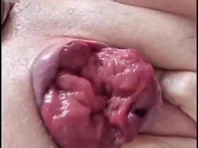 Prolapse mandate agay indonesian joyous porn