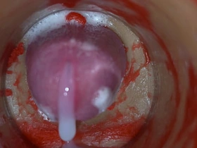 Insemination - Internal Camera Captures Deep Bamboozle start off Interjection hot tamil gay porn