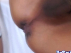 Asian MD slams patient after enema jin japan gay porn